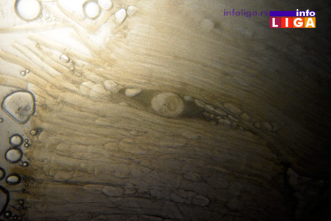 IL-trihinela2 Oprez! U Ivanjici svinjsko meso zaraženo trihinelom